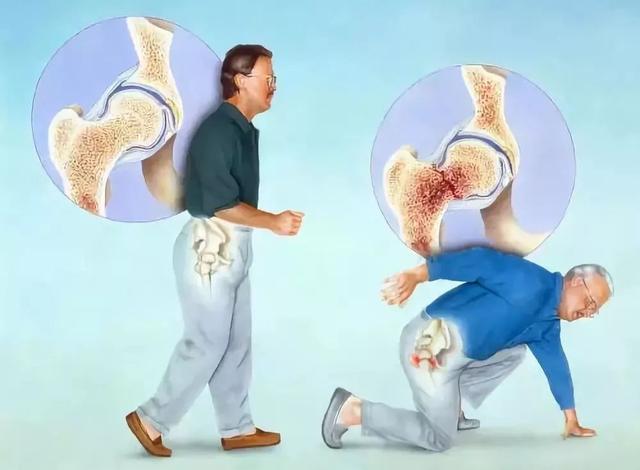 骨骼的 “健康悄悄话”，双能 X 射线骨密度仪帮你 “听清楚”！