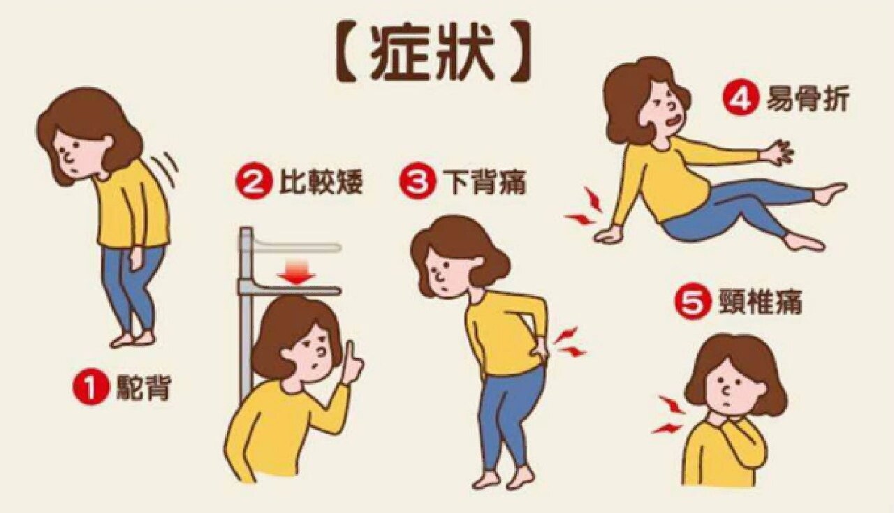 骨骼的 “健康悄悄话”，双能 X 射线骨密度仪帮你 “听清楚”！