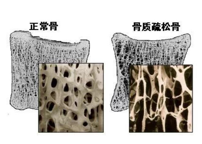 探究骨骼的秘密：从结构功能到健康守护