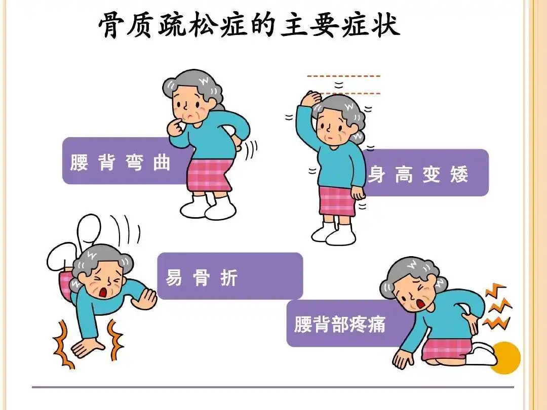 骨骼健康“成绩单”：解读骨密度仪测量数据，看清你的生命支撑根基